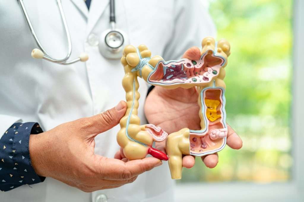 Intestine, appendix and digestive system, doctor holding anatomy model for study diagnosis